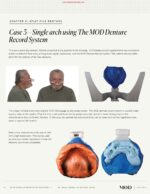 3D Printing in Restorative Dentistry 2023 - Image 4