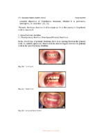 Illustrated Pediatric Dentistry (Part 1) 2022 - Image 9