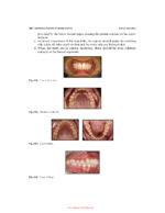 Illustrated Pediatric Dentistry (Part 1) 2022 - Image 11
