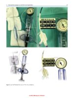 Atlas of Head and Neck Surgery 2024 - Image 2