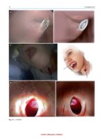 Atlas of Head and Neck Surgery 2024 - Image 3