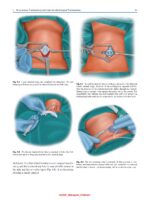 Atlas of Head and Neck Surgery 2024 - Image 4