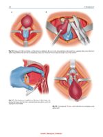 Atlas of Head and Neck Surgery 2024 - Image 5