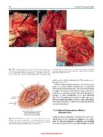 Atlas of Head and Neck Surgery 2024 - Image 6