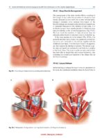 Atlas of Head and Neck Surgery 2024 - Image 7
