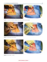 Atlas of Head and Neck Surgery 2024 - Image 8
