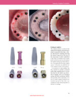 Implant Prosthodontics Protocols and Techniques for Fixed Implant Restorations 2022 - Image 5