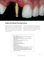 Implant Prosthodontics Protocols and Techniques for Fixed Implant Restorations 2022 - Image 7