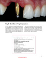 Implant Prosthodontics Protocols and Techniques for Fixed Implant Restorations 2022 - Image 7