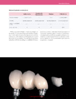 Implant Prosthodontics Protocols and Techniques for Fixed Implant Restorations 2022 - Image 8