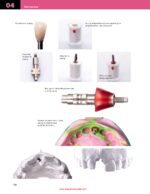 Implant Prosthodontics Protocols and Techniques for Fixed Implant Restorations 2022 - Image 10