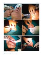 Oral and Maxillofacial Surgery for the Clinician 2021 - Image 4