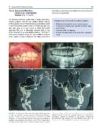 Oral and Maxillofacial Surgery for the Clinician 2021 - Image 7