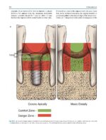 Oral and Maxillofacial Surgery for the Clinician 2021 - Image 8