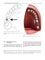Oral and Maxillofacial Surgery for the Clinician 2021 - Image 9