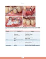 Periodontics The Complete Summary 2021 - Image 4