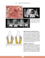 Periodontics The Complete Summary 2021 - Image 5