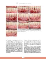 Periodontics The Complete Summary 2021 - Image 7
