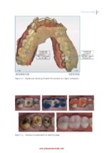 Practical Procedures in Dental Occlusion 2022 - Image 6