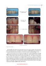Practical Procedures in Dental Occlusion 2022 - Image 5