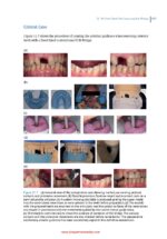 Practical Procedures in Dental Occlusion 2022 - Image 4