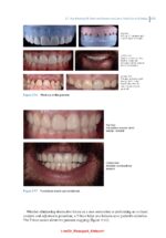 Practical Procedures in Dental Occlusion 2022 - Image 3