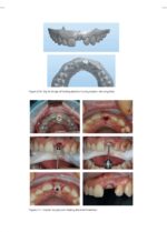 Practical Procedures in Implant Dentistry 2022 - Image 6