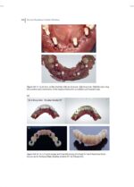 Practical Procedures in Implant Dentistry 2022 - Image 7