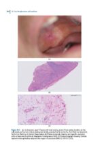 Sexually Transmissible Oral Diseases 2023 - Image 6