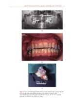 Temporomandibular Disorders A Problem-Based Approach 2nd 2021 - Image 2