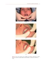 Temporomandibular Disorders A Problem-Based Approach 2nd 2021 - Image 7