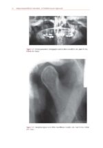 Temporomandibular Disorders A Problem-Based Approach 2nd 2021 - Image 6