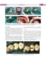 Textbook of Conservative & Restorative Dentistry 2020 - Image 6