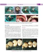Textbook of Conservative & Restorative Dentistry 2020 - Image 6
