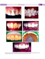 Textbook of Conservative & Restorative Dentistry 2020 - Image 5