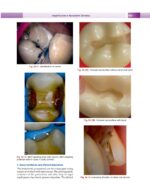 Textbook of Conservative & Restorative Dentistry 2020 - Image 3