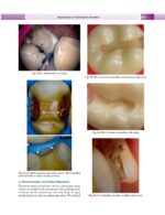 Textbook of Conservative & Restorative Dentistry 2020 - Image 3