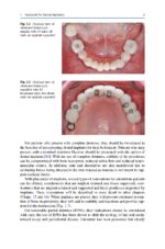 Treatment Planning in Implant Dentistry 2024 - Image 12