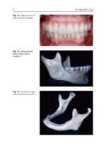Treatment Planning in Implant Dentistry 2024 - Image 11