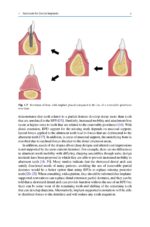 Treatment Planning in Implant Dentistry 2024 - Image 10