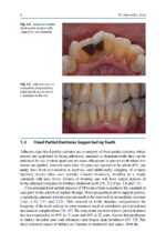 Treatment Planning in Implant Dentistry 2024 - Image 9