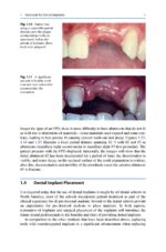 Treatment Planning in Implant Dentistry 2024 - Image 8