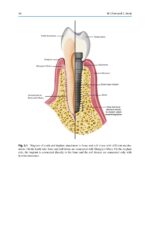 Treatment Planning in Implant Dentistry 2024 - Image 7