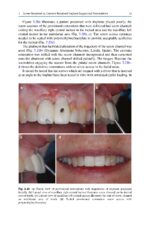 Treatment Planning in Implant Dentistry 2024 - Image 6