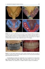 Treatment Planning in Implant Dentistry 2024 - Image 4