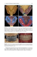 Treatment Planning in Implant Dentistry 2024 - Image 4