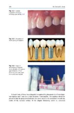 Treatment Planning in Implant Dentistry 2024 - Image 3