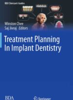 Treatment Planning in Implant Dentistry 2024