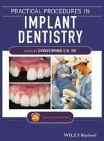 Practical Procedures in Implant Dentistry 2022