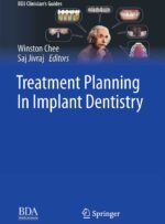 Treatment Planning in Implant Dentistry 2024